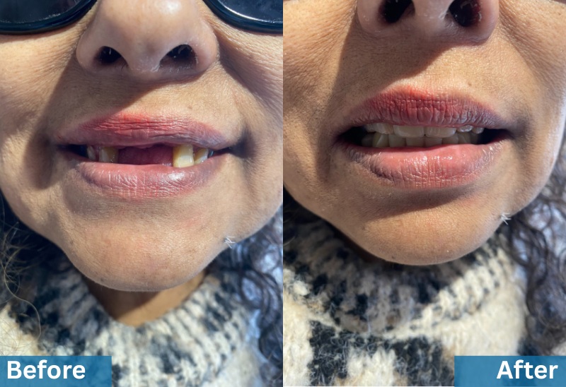 Your paragraph text - 1